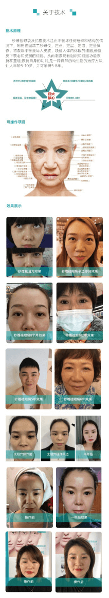4e8177dfb22f82068e077a1338f5fc15858613.png 伊圣尔美秒雕企业故事-裂解平衡术的发展370.png
